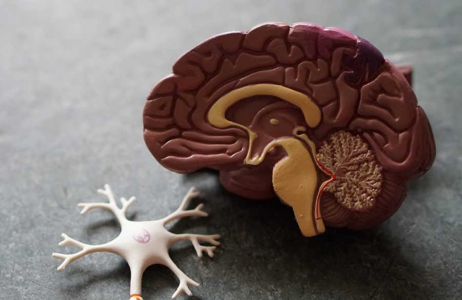 neuroradiology - Neurosurgery