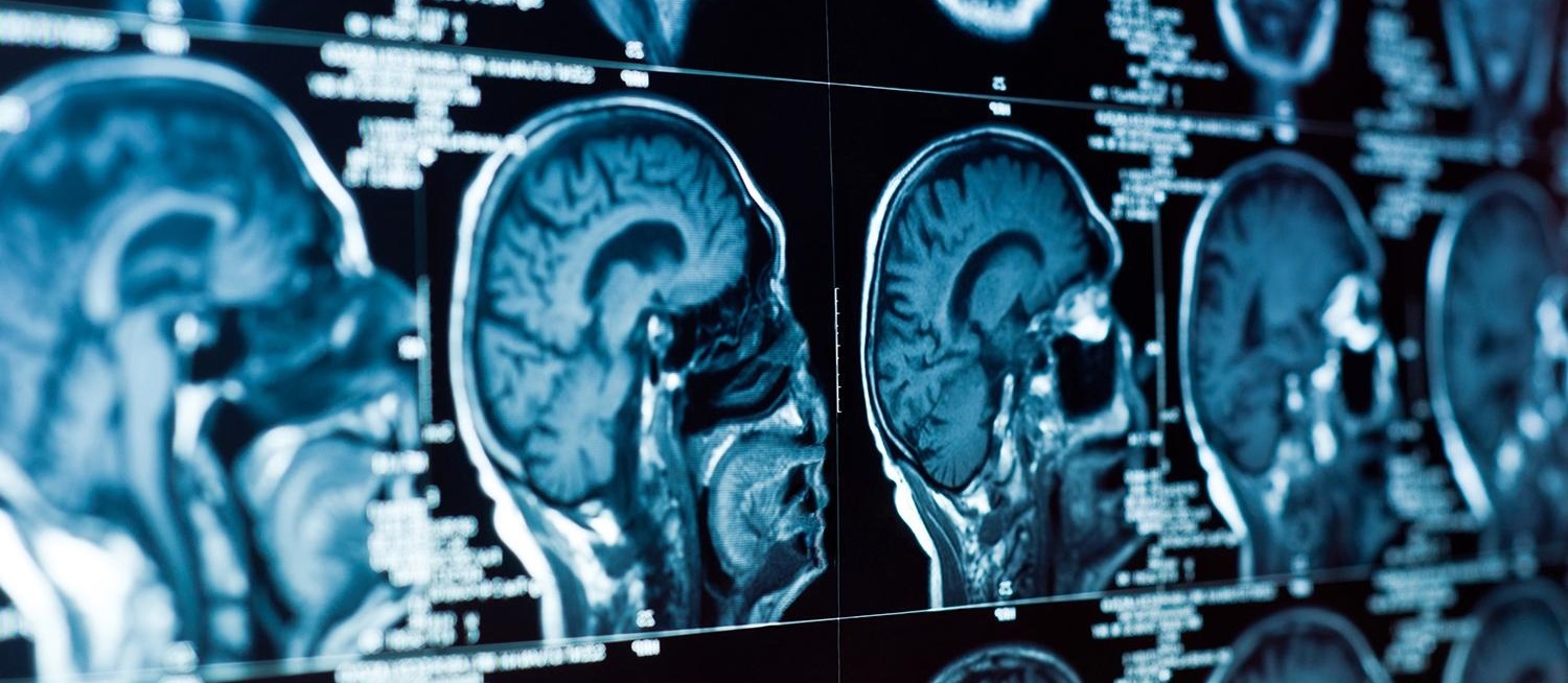 ct scan banner - Κέντρο Οξέος Εγκεφαλικού (Stroke Unit)