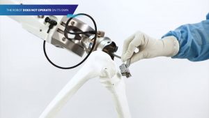 rosa knee robot video preview 300x169 - rosa knee robot video preview