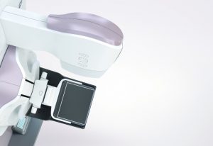 mammographysm 1 300x206 - mammographysm (1)