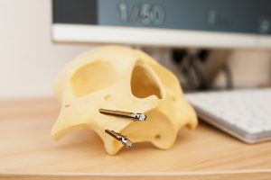 maxillofacial mediterraneo hospital 300x200 - maxillofacial_mediterraneo hospital