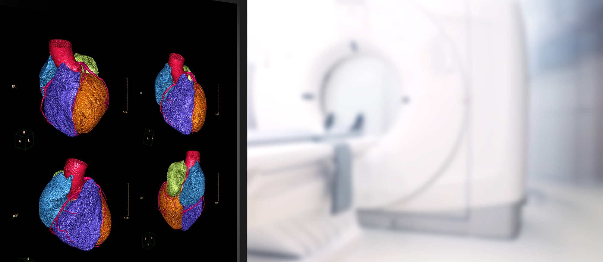 ct coronary angiography mediterraneo hospital banner - Αξονική Στεφανιογραφία
