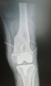 EIK 4 178x300 - EIK 4
