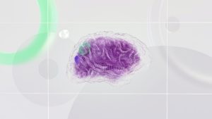 STROKEDAY 300x169 - STROKEDAY